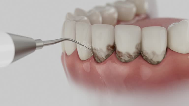 Reliable Dental Implants contractor in Cedartown, GA by Smile Center Dentistry
